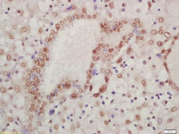HOXA13 Polyclonal Antibody