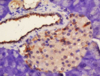 Kv beta 2 Polyclonal Antibody