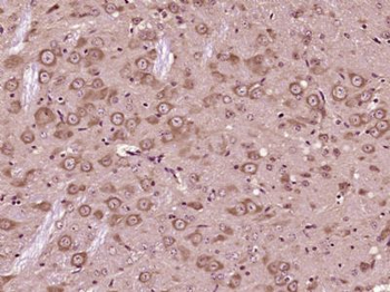 KCNG1 Polyclonal Antibody