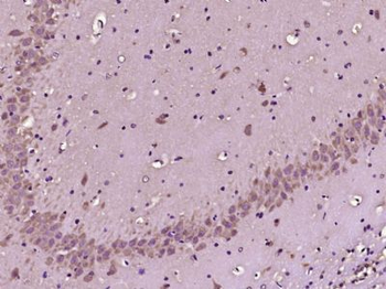 SCN7A Polyclonal Antibody