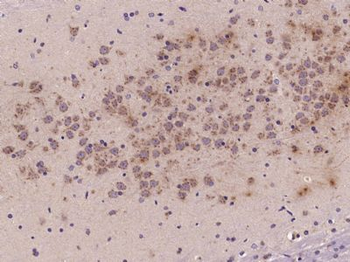 Semaphorin 3D Polyclonal Antibody