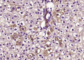 BTD Polyclonal Antibody