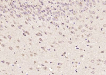 SMUBP2 Polyclonal Antibody