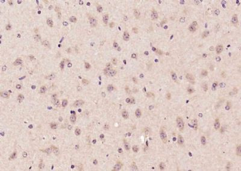 Advillin Polyclonal Antibody