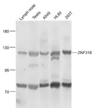 ZNF318 Polyclonal Antibody