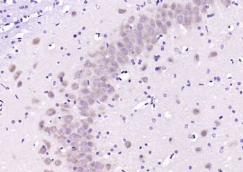 PCP4 Polyclonal Antibody