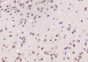 Exportin 5 Polyclonal Antibody