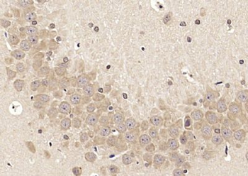 LRFN2 Polyclonal Antibody