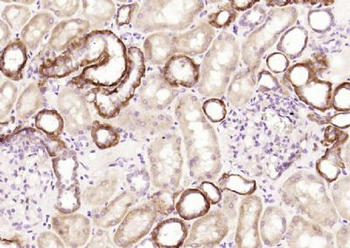 CCBL1 Polyclonal Antibody