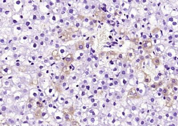 MTP18 Polyclonal Antibody