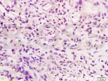 Integrin beta 7 Polyclonal Antibody