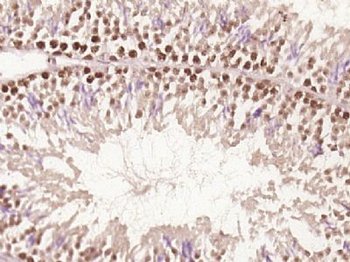 Tex14 Polyclonal Antibody