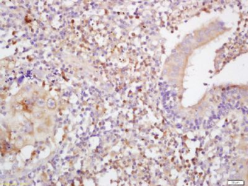 MHC class I/HLA-C Polyclonal Antibody