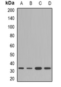 Anti-HSD17B13 Antibody