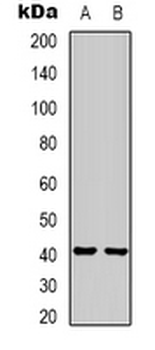 Anti-HAO1 Antibody