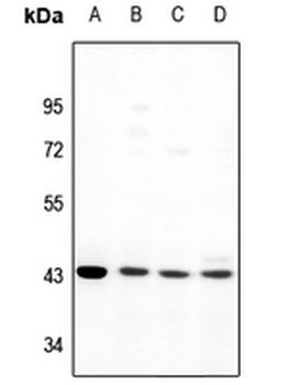 Anti-GPR170 Antibody