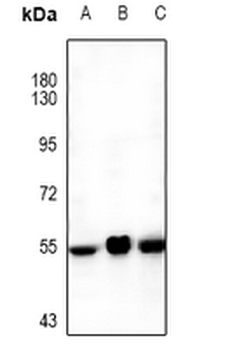 Anti-Orexin Receptor 1 Antibody