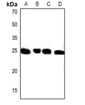 Anti-PXMP4 Antibody
