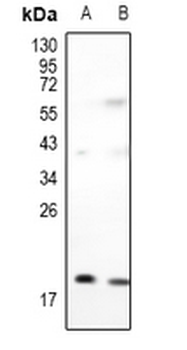 Anti-Adenylate Kinase 1 Antibody