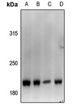 Anti-Von Willebrand Factor Antibody