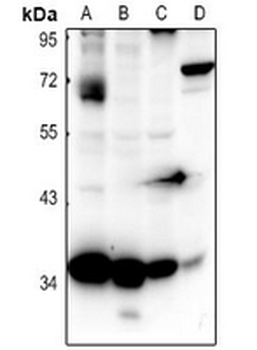 Anti-CD363 Antibody