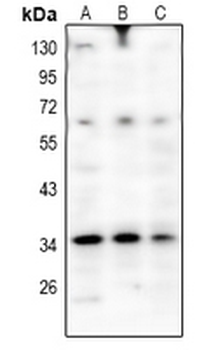 Anti-OSR2 Antibody