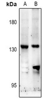Anti-NMDAR2C Antibody