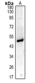Anti-Podocan Antibody
