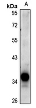 Anti-DCR3 Antibody