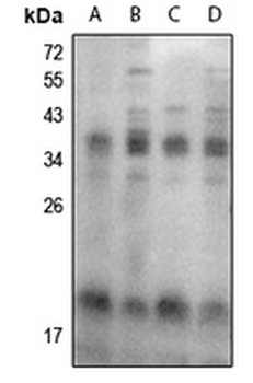 Anti-FHIT (pY114) Antibody