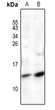Anti-POLR2J Antibody