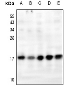 Anti-RPL31 Antibody