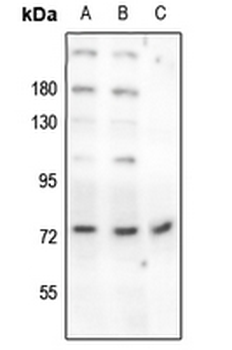 Anti-Beta-NaCH (pT615) Antibody
