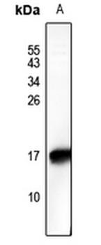 Anti-HMGN2 (pS29) Antibody