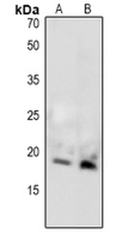 Anti-MBP (pT232) Antibody