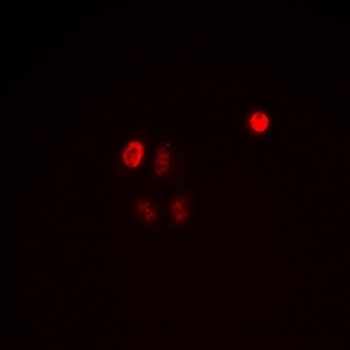 Anti-C/EBP epsilon (pT74) Antibody