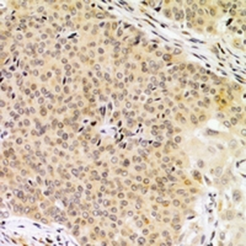 Anti-KPC2 Antibody