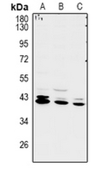 Anti-RCL1 Antibody