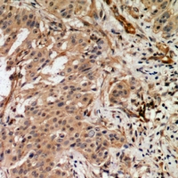 Anti-RAB3GAP2 Antibody