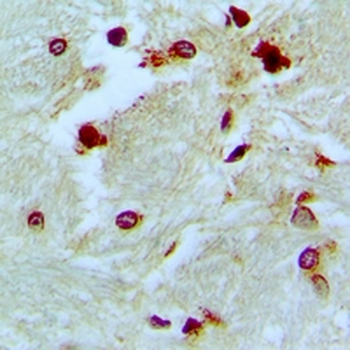 Anti-p46 Antibody