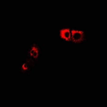 Anti-GPR66 Antibody