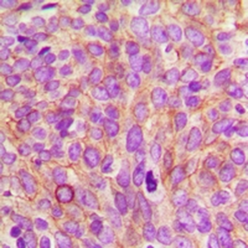 Anti-CEP55 Antibody