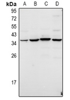 Anti-TWIK3 Antibody