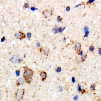 Anti-GABRB2 Antibody