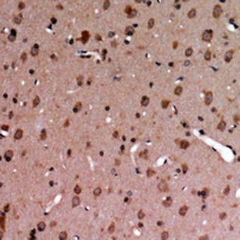 Anti-MERTK/TYRO3 (pY749/681) Antibody