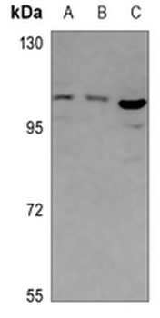 Anti-ABCF1 Antibody