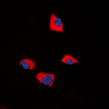 Anti-FUK Antibody