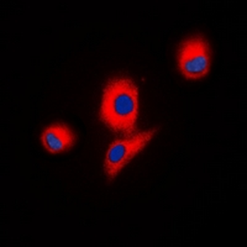 Anti-ICK Antibody