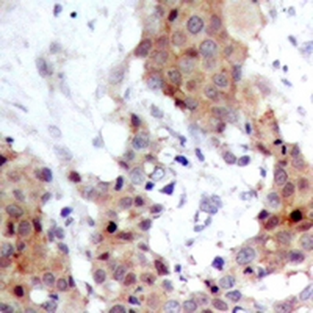 Anti-FOXO1/3 Antibody