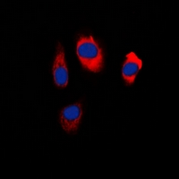 Anti-EDG5 Antibody